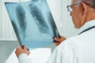  Secretaría Departamental de Salud hace un llamado a la población de Casanare para que adopte medidas de autocuidado, que permitan identificar oportunamente los casos de esta patología.