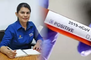 La secretaria de Salud de Yopal, Ingrid Zoraya Criollo Fonseca, informó que se tomarán pruebas de forma aleatoria a algunos contactos estrechos debido al tiempo de exposición pueden esta contagiados con Covid-19.