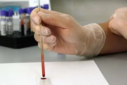 El departamento de Arauca con 189 casos de Covid-19 confirmados y 76 recuperados.