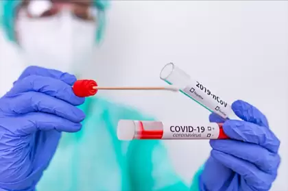 26 casos nuevos de Covid-19 reportó la Unidad Administrativa Especial de Salud de Arauca.