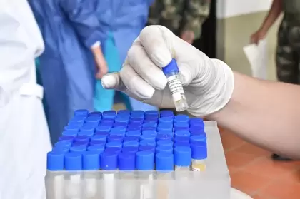 Arauca registra 1.428 casos confirmados, 1066 recuperados y 29 pacientes fallecidos por Covid-19.