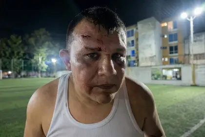 en pleno partido de fútbol. La familia del agredido anunció que harán la denuncia ante las autoridades.