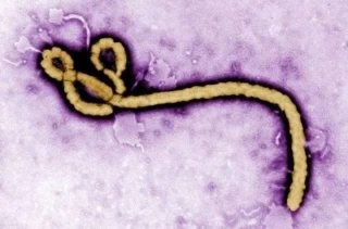 El ébola presenta una elevada mortalidad, que varía entre el 30 y el 90egún la cepa.